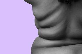 Gordofobia y el estigma del peso