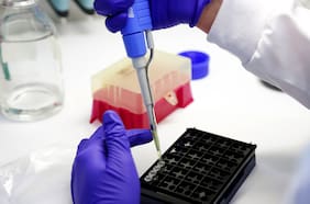 Madagascar registra su primer fallecimiento por coronavirus