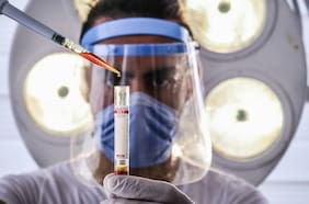Nuevo test de sangre detecta el alzhéimer y mide su grado de progreso con 92% de precisión