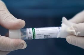 A tres meses de su detección “variante andina” es ahora la segunda con mayor circulación en Chile