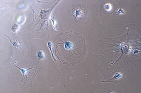 Las temibles células zombies que nos hacen envejecer: científicos están descifrando cómo destruirlas