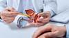 Qué es el cáncer de próstata y a qué edad hacerse exámenes preventivos, según especialistas