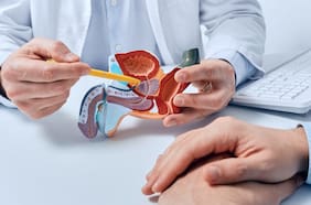 Qué es el cáncer de próstata y a qué edad hacerse exámenes preventivos, según especialistas