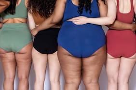 ¿Tener muslos grandes y celulitis podría beneficiar tu salud? Esto dice un nuevo estudio