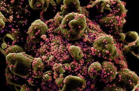 “El virus siempre será una pandemia”: Especialista en bioseguridad global destruye idea de evolución benigna del Covid-19