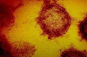 Variante surgida en Brasil posee la misma mutación que la del Reino Unido y Sudáfrica: todas son más contagiosas