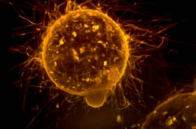 3 infecciones comunes que pueden provocar cáncer (y cómo prevenirlas)