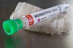 Estas son las tres formas más fáciles de contagiarse de la viruela del mono