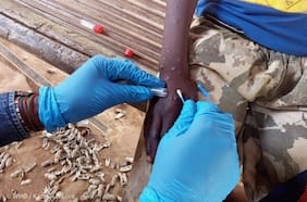 La viruela del mono no está controlada en África, advierten desde el CDC del continente