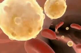 Descubren forma de limpiar las arterias que podría prevenir enfermedades cardiovasculares