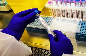 Las zonas más golpeadas por el alza de casos de Covid-19: Más del 20% de sus contagios durante toda la pandemia se produjeron en las últimas dos semanas