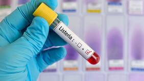 Qué es la listeria, la peligrosa bacteria detectada en dos productos en Chile