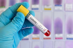 Qué es la listeria, la peligrosa bacteria detectada en dos productos en Chile