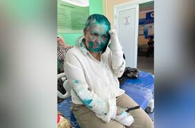 Washington pide investigar a responsables del “salvaje ataque” a galardonada periodista rusa Yelena Milashina