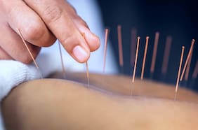 Cómo la acupuntura puede “reconfigurar” el cerebro de las personas con depresión, según un estudio