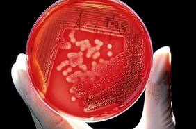 Detectan casos de gonorrea resistente en Reino Unido