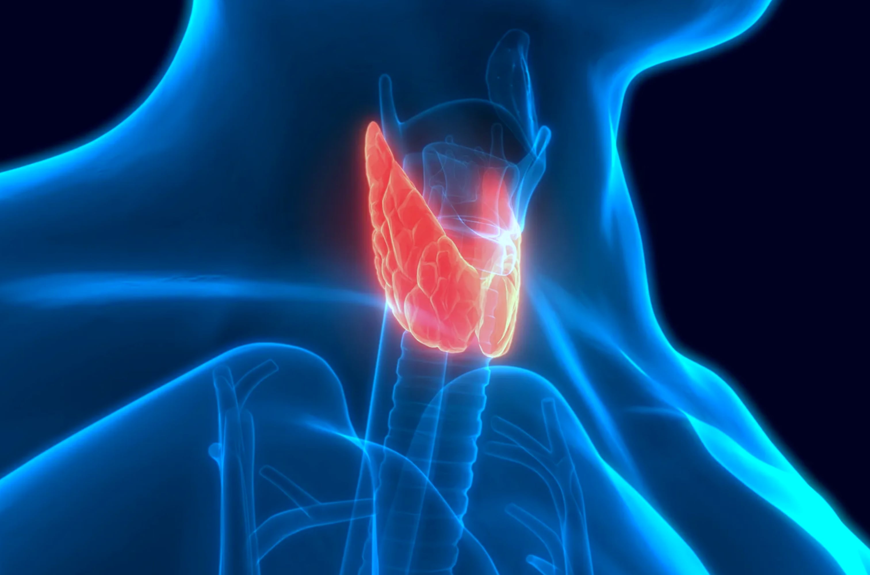 Cáncer de tiroides: qué es y cuáles son los factores de riesgo y las señales de alerta. Foto: referencial.
