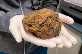 Descubren momia de 30 mil años más extraña que se haya visto: con rayos X pudieron dar con su origen