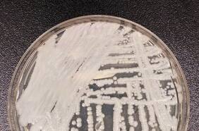 Nuevo hongo mortal Candida auris se expande peligrosamente: ¿quiénes son más susceptibles?