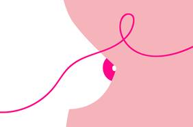 Mitos y realidades en torno al cáncer de mama