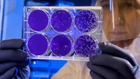 Encuentran un virus “oculto” en el intestino que podría estar vinculado al cáncer de colon