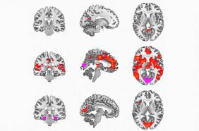 Droga psicodélica DMT podría ser usada para tratar la depresión