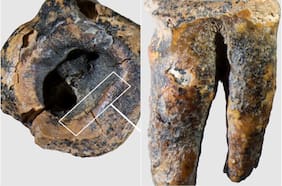 El hallazgo de un diente de 59.000 años de antigüedad revela cómo los neandertales trataban las caries, según un estudio