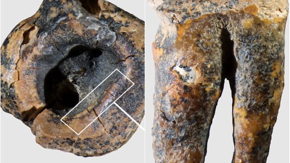 El hallazgo de un diente de 59.000 años de antigüedad revela cómo los neandertales trataban las caries, según un estudio