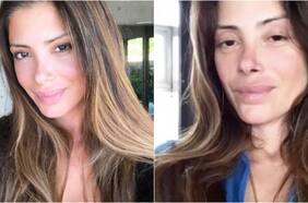 El país que prohibió que influencers hablen sobre cirugías o dietas mágicas