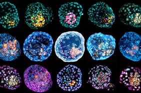 Científicos crean modelo artificial de embrión humano a partir de células de la piel