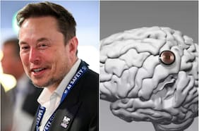 Neuralink volverá a implantar un chip cerebral: estos son los “superpoderes” que anunció Elon Musk