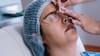 ¿Podría reemplazar a Lasik? Científicos exploran una alternativa para corregir la vista sin láser ni incisiones