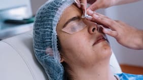 ¿Podría reemplazar a Lasik? Científicos exploran una alternativa para corregir la vista sin láser ni incisiones