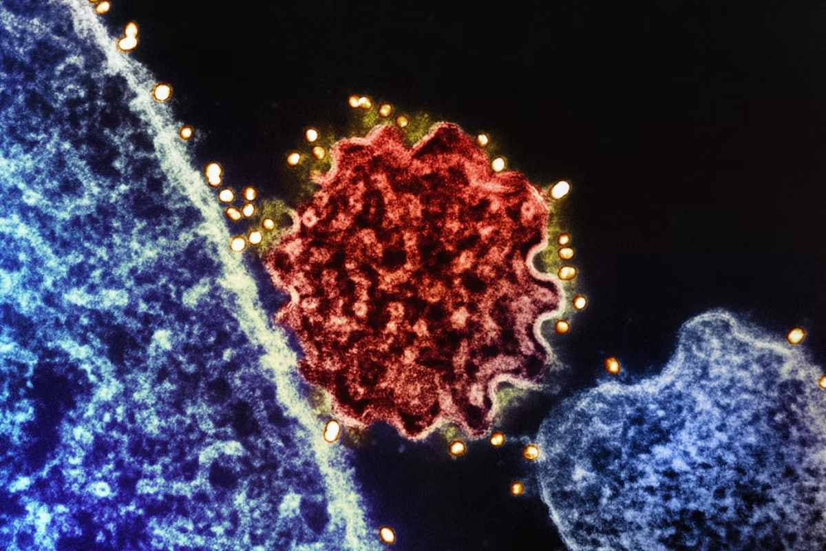 Las 5 infecciones responsables de más de 2 millones de casos de cáncer, según un estudio