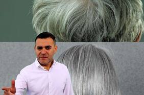 Científicos descubren método que podría revertir aparición de las canas