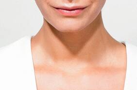 El problema del escote