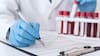 Científicos desarrollan un examen de sangre que promete detectar múltiples tipos de cáncer y dónde se originaron