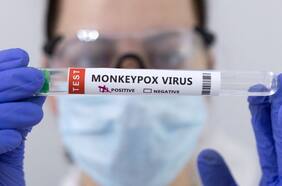 Suecia confirma un primer caso de mpox fuera de África de la variante más grave