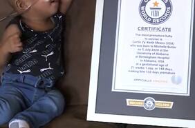Bebé prematuro bate el récord al nacer a las 21 semanas de gestación