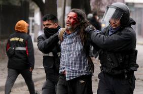 CIDH alerta del uso excesivo de la fuerza durante protestas en la provincia argentina de Jujuy