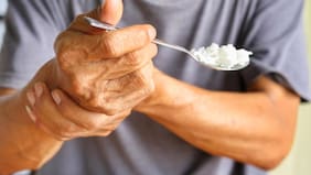 4 síntomas de la enfermedad de Parkinson que pueden aparecer antes del diagnóstico