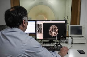 Nuevo instituto interdisciplinario aplicará Inteligencia Artificial para realizar resonancias magnéticas en cinco minutos