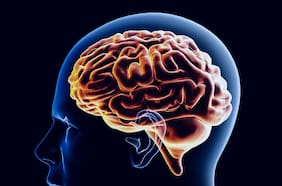 Estos son los trastornos que están relacionados con un envejecimiento cerebral más rápido, según un estudio