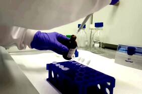 Estudio revela que prueba de saliva puede diagnosticar una lesión cerebral