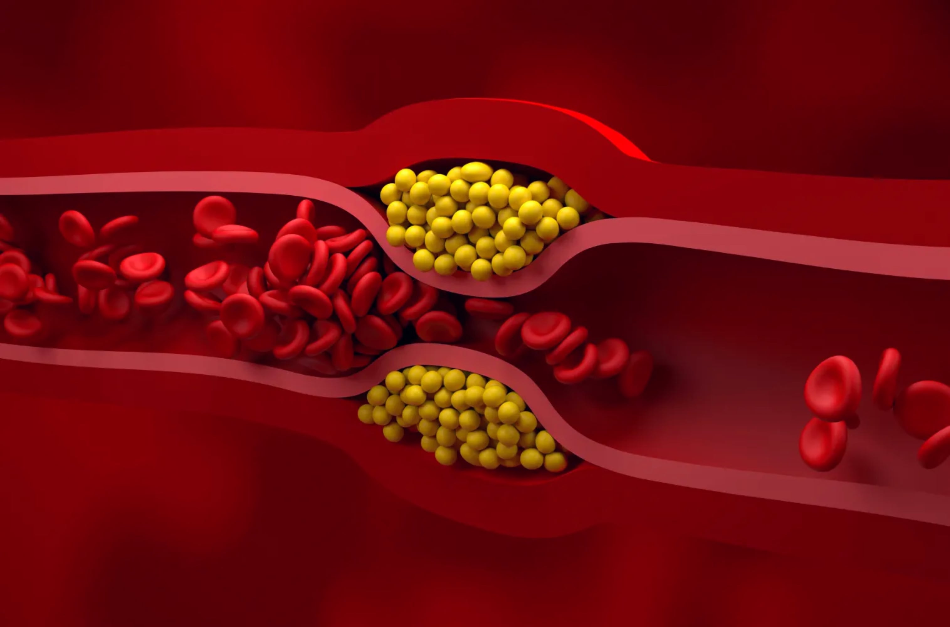 La terapia experimental que redujo el colesterol “malo” a la mitad en una sola dosis