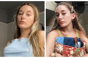 Endometriosis: qué es la enfermedad que afecta a Tatiana Farkas y cómo identificarla