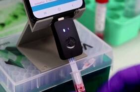 Desarrollan test de Covid-19 para smartphones que podría dar resultados en 10 minutos