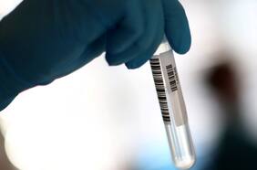 Variante brasileña se consolida como la de mayor circulación en el país y aumenta su diferencia respecto de la andina