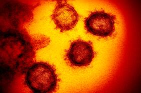 ¿Es la variante Mu más peligrosa que Delta?