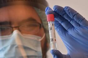 Reinfección por coronavirus: ¿Es posible que veamos casos en Chile?